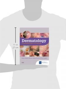 Dermatology fundamentals of practice