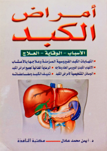 أمراض الكبد الاسباب _ الوقاية _ العلاج